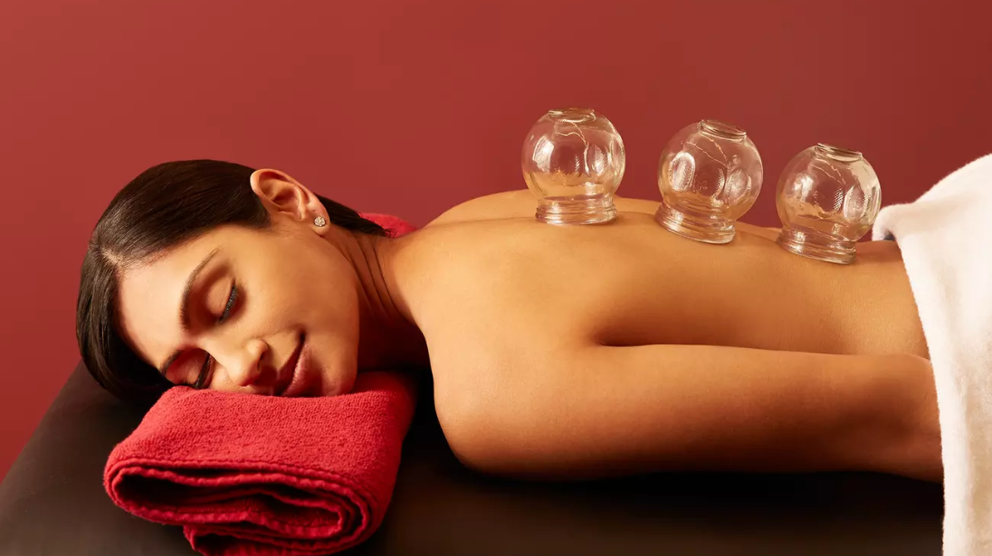 Chinese Cupping Therapy Deal – Relaxation, Circulation & Healing Benefits